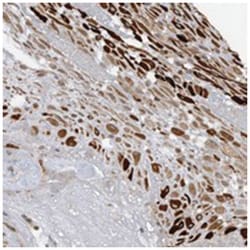 PGBD2 Rabbit anti-Human, Polyclonal Antibody, Abnova 100&mu;L; Unlabeled:Antibodies,