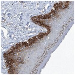 SLC26A11, Rabbit, Polyclonal Antibody, Abnova 100&mu;L; Unlabeled:Antibodies,