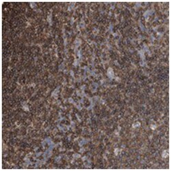 RSPO3, Rabbit, Polyclonal Antibody, Abnova 100&mu;L; Unlabeled:Antibodies,