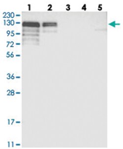 NHSL1, Rabbit, Polyclonal Antibody, Abnova 100 &mu;L | Buy Online | Abnova Corporation | Fisher Scientific