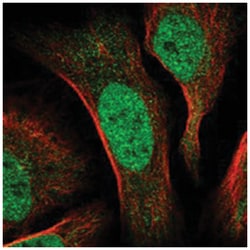 CDCA2 Rabbit anti-Human, Polyclonal Antibody, Abnova 100&mu;L; Unlabeled:Antibodies,