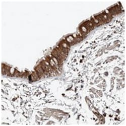 SMYD4, Rabbit, Polyclonal Antibody, Abnova 100 &mu;L | Buy Online | Abnova Corporation | Fisher Scientific