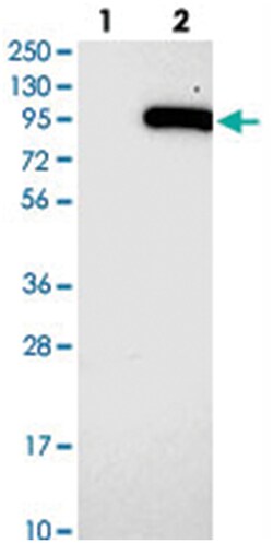 SMYD4, Rabbit, Polyclonal Antibody, Abnova 100 &mu;L | Buy Online | Abnova Corporation | Fisher Scientific