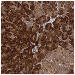 LURAP1 Rabbit anti-Human, Polyclonal Antibody, Abnova 100 &mu;L | Buy Online | Abnova Corporation | Fisher Scientific