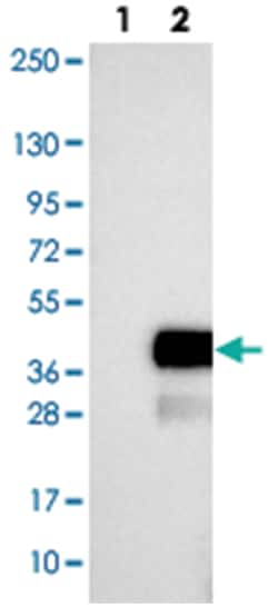 LURAP1 Rabbit anti-Human, Polyclonal Antibody, Abnova 100&mu;L; Unlabeled:Antibodies,