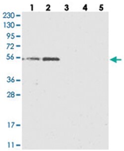 KCTD20, Rabbit, Polyclonal Antibody, Abnova 100 &mu;L | Buy Online | Abnova Corporation | Fisher Scientific