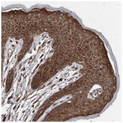 KCTD20, Rabbit, Polyclonal Antibody, Abnova 100 &mu;L | Buy Online | Abnova Corporation | Fisher Scientific