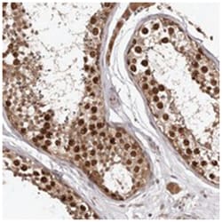 RNF187, Rabbit, Polyclonal Antibody, Abnova 100 &mu;L | Buy Online | Abnova Corporation | Fisher Scientific