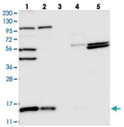 FAM136A Rabbit anti-Human, Polyclonal Antibody, Abnova 100 &mu;L | Buy Online | Abnova Corporation | Fisher Scientific