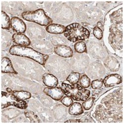 FLJ22374 Rabbit anti-Human, Polyclonal Antibody, Abnova 100&mu;L; Unlabeled:Antibodies,