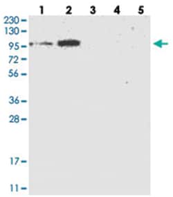 FLJ22374 Rabbit anti-Human, Polyclonal Antibody, Abnova 100 &mu;L | Buy Online | Abnova Corporation | Fisher Scientific