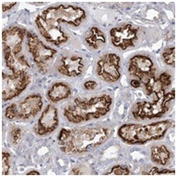 FLJ22374 Rabbit anti-Human, Polyclonal Antibody, Abnova 100 &mu;L | Buy Online | Abnova Corporation | Fisher Scientific