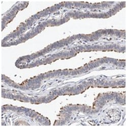 LACE1 Rabbit anti-Human, Mouse, Polyclonal Antibody, Abnova 100 &mu;L | Buy Online | Abnova | Fisher Scientific