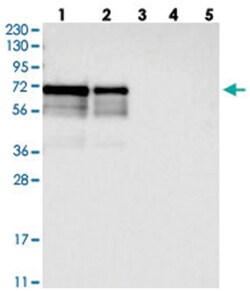 LTV1 Rabbit anti-Human, Polyclonal Antibody, Abnova 100&mu;L; Unlabeled:Antibodies,
