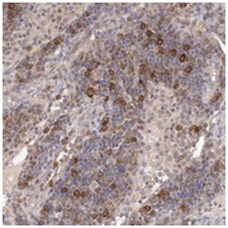 LTV1 Rabbit anti-Human, Polyclonal Antibody, Abnova 100&mu;L; Unlabeled:Antibodies,