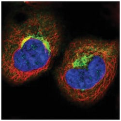 TJAP1 Rabbit anti-Human, Polyclonal Antibody, Abnova 100 &mu;L | Buy Online | Abnova Corporation | Fisher Scientific