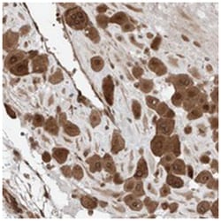 KIAA1009 Rabbit anti-Human, Polyclonal Antibody, Abnova 100 &mu;L | Buy Online | Abnova Corporation | Fisher Scientific