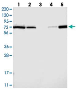 AGPS Rabbit anti-Human, Polyclonal Antibody, Abnova 100 &mu;L | Buy Online | Abnova Corporation | Fisher Scientific