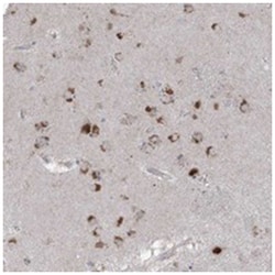 AGPS Rabbit anti-Human, Polyclonal Antibody, Abnova 100 &mu;L | Buy Online | Abnova Corporation | Fisher Scientific