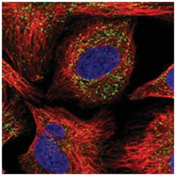 AGPS Rabbit anti-Human, Polyclonal Antibody, Abnova 100 &mu;L | Buy Online | Abnova Corporation | Fisher Scientific