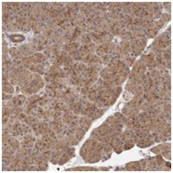 MLLT4 Rabbit anti-Human, Polyclonal Antibody, Abnova 100 &mu;L | Buy Online | Abnova Corporation | Fisher Scientific