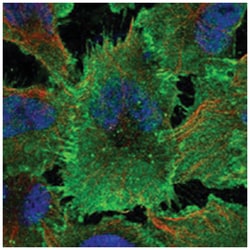 MLLT4 Rabbit anti-Human, Polyclonal Antibody, Abnova 100 &mu;L | Buy Online | Abnova Corporation | Fisher Scientific