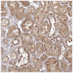 MTO1 Rabbit anti-Human, Polyclonal Antibody, Abnova 100&mu;L; Unlabeled:Antibodies,