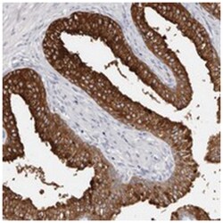 C1orf62 Rabbit anti-Human, Polyclonal Antibody, Abnova 100 &mu;L | Buy Online | Abnova Corporation | Fisher Scientific