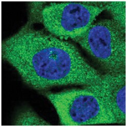 C1orf62 Rabbit anti-Human, Polyclonal Antibody, Abnova 100 &mu;L | Buy Online | Abnova Corporation | Fisher Scientific