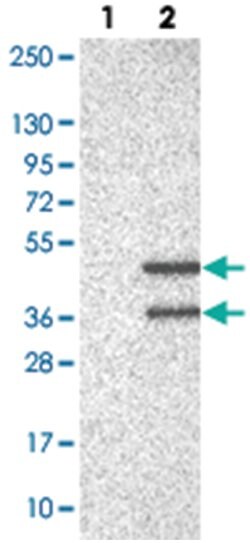 UFD1L Rabbit anti-Human, Polyclonal Antibody, Abnova 100 &mu;L | Buy Online | Abnova Corporation | Fisher Scientific