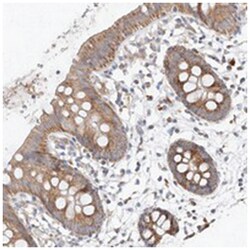 MRPL24 Rabbit anti-Human, Polyclonal Antibody, Abnova 100&mu;L; Unlabeled:Antibodies,