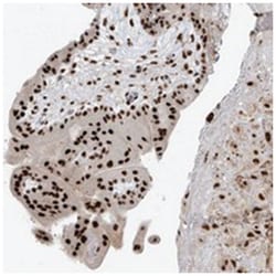 PM20D2, Rabbit, Polyclonal Antibody, Abnova 100 &mu;L | Buy Online | Abnova | Fisher Scientific