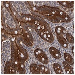FRMD1 Rabbit anti-Human, Polyclonal Antibody, Abnova 100 &mu;L | Buy Online | Abnova Corporation | Fisher Scientific