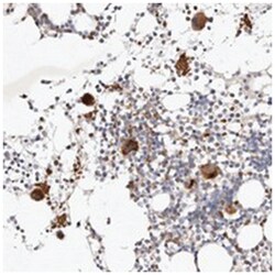 MTMR11, Rabbit, Polyclonal Antibody, Abnova 100&mu;L; Unlabeled:Antibodies,