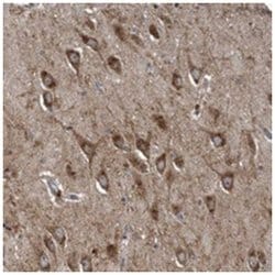 LYRM4, Rabbit, Polyclonal Antibody, Abnova 100&mu;L; Unlabeled:Antibodies,