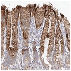 ZYG11A, Rabbit, Polyclonal Antibody, Abnova 100 &mu;L | Buy Online | Abnova Corporation | Fisher Scientific