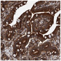 TNFRSF13B Rabbit anti-Human, Polyclonal Antibody, Abnova 100 &mu;L | Buy Online | Abnova | Fisher Scientific