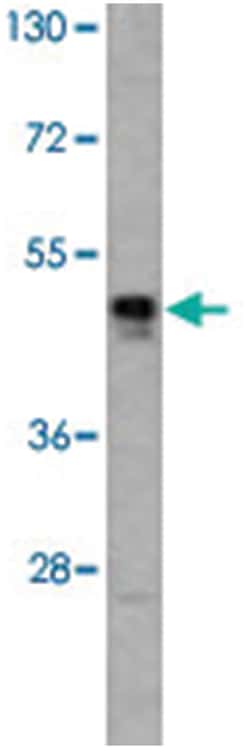 HAT1 Rabbit anti-Human, Polyclonal Antibody, Abnova 400&mu;L; Unlabeled:Antibodies,