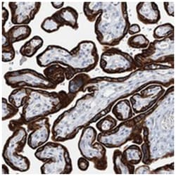 RPTN, Rabbit, Polyclonal Antibody, Abnova 100 &mu;L | Buy Online | Abnova Corporation | Fisher Scientific