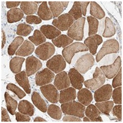 KCNH5, Rabbit, Polyclonal Antibody, Abnova 100 &mu;L | Buy Online | Abnova Corporation | Fisher Scientific