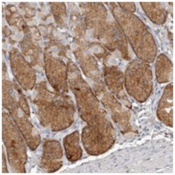 SLC39A2 Rabbit anti-Human, Polyclonal Antibody, Abnova 100&mu;L; Unlabeled:Antibodies,