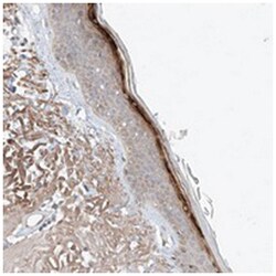 TSR2, Rabbit, Polyclonal Antibody, Abnova 100 &mu;L | Buy Online | Abnova | Fisher Scientific