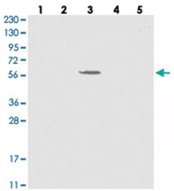 SLC43A3, Rabbit, Polyclonal Antibody, Abnova 100&mu;L; Unlabeled:Antibodies,