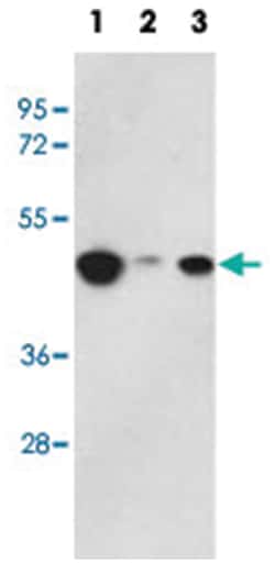 HAT1 Rabbit anti-Human, Polyclonal Antibody, Abnova 400 &mu;L | Buy Online | Abnova | Fisher Scientific