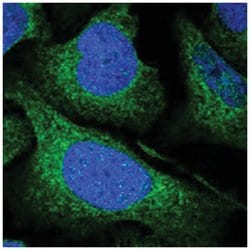 UFL1 Rabbit anti-Human, Polyclonal Antibody, Abnova 100 &mu;L | Buy Online | Abnova Corporation | Fisher Scientific