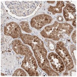 C6orf62 Rabbit anti-Human, Polyclonal Antibody, Abnova 100&mu;L; Unlabeled:Antibodies,