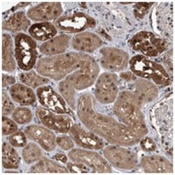 BHLHE23, Rabbit, Polyclonal Antibody, Abnova 100 &mu;L | Buy Online | Abnova Corporation | Fisher Scientific