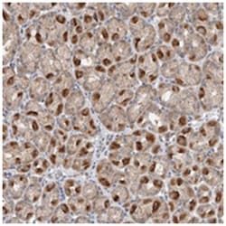 LRRC16B, Rabbit, Polyclonal Antibody, Abnova 100 &mu;L | Buy Online | Abnova Corporation | Fisher Scientific
