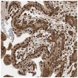 ZNF195, Rabbit, Polyclonal Antibody, Abnova 100&mu;L; Unlabeled:Antibodies,