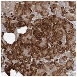 TMEM61, Rabbit, Polyclonal Antibody, Abnova 100&mu;L; Unlabeled:Antibodies,